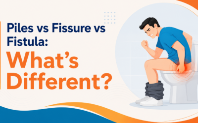 Piles vs Fissure vs Fistula: What’s Different?