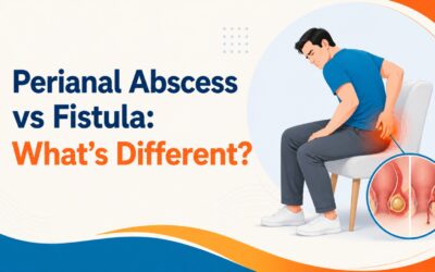 Perianal Abscess vs Fistula: What’s Different?