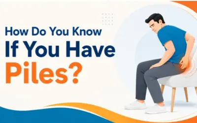 How Do You Know If You Have Piles? Signs You Should Not Ignore